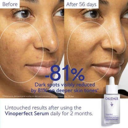 Before and after comparison of skin using Caudalie Vinoperfect Brightening Dark Spot Serum